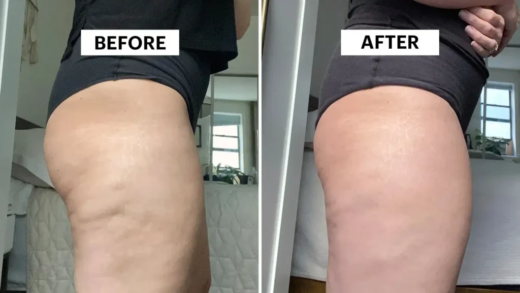 Do Toning Exercise Edgware Really Tackle Cellulite?